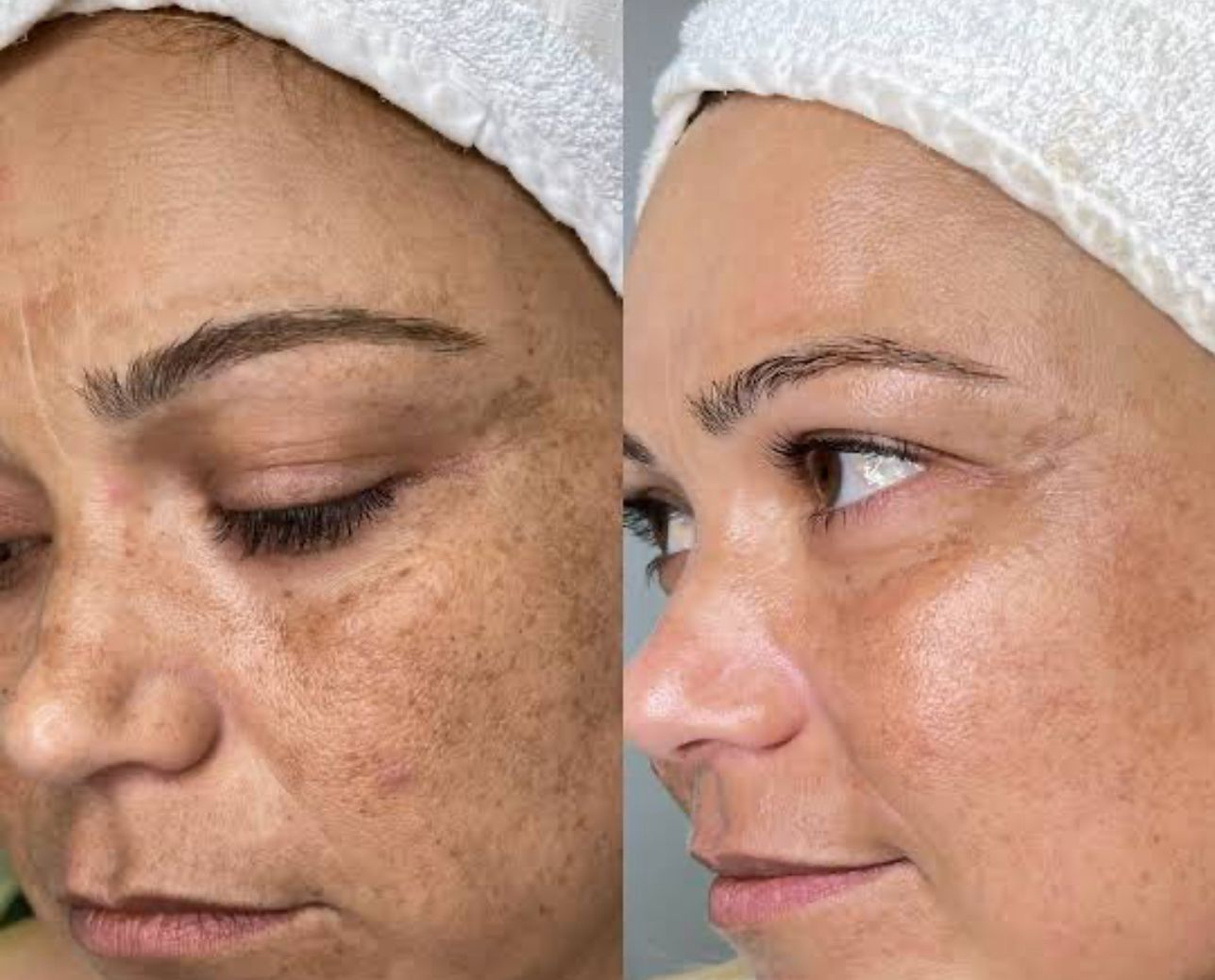 Cilt tedavileri görsel 2