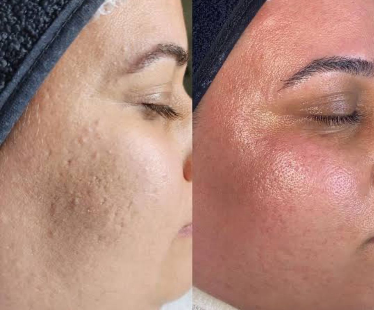 Cilt tedavileri görsel 3