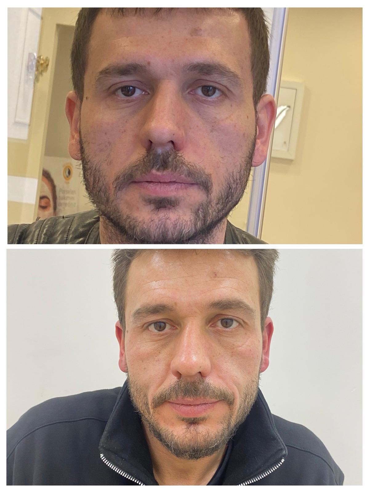 Cilt tedavileri görsel 1