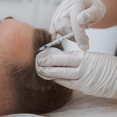 Saç Dökülme Tedavisi