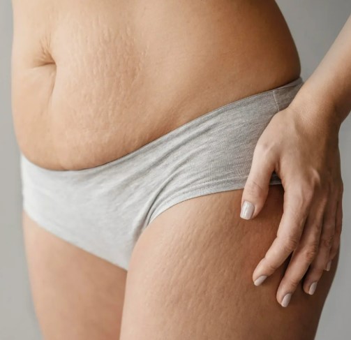 Çatlak Bakımı Öncesi Sonrası